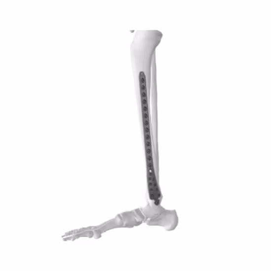 Variable Angle Two-Column Volar Distal Radius Locking Compression Bone Plate, Va LCP System, Titanium Orthopedic Surgical Implant for Trauma Surgery, CE&ISO