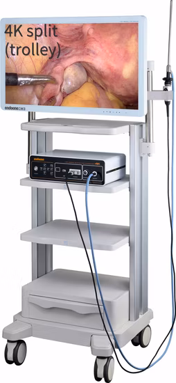 Unidade de câmera endoscópica CCD / HD Sistema portátil de câmera endoscópica para laparoscopia / histeroscopia / urologia / Ent / artroscopia